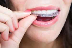 A woman using invisible braces