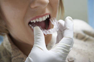 Are Clear Braces Right For You? The Advantages of Clear Braces