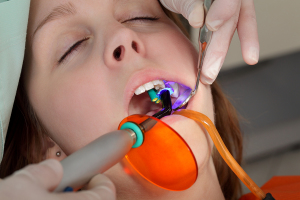 Is Laser Periodontal Therapy Right For You?