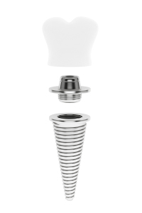 Mini Dental Implants vs. Their Traditional Counterparts