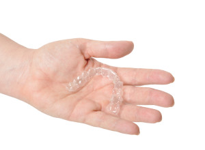 Invisalign Clear Braces – Frequently Asked Questions