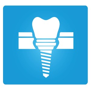 6 Physical And Social Benefits Of Dental Implants