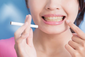 The Effects of Smoking on Dental Implants