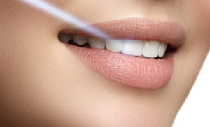 Don't Let These Myths Shy You Away From Receiving Laser Dentistry