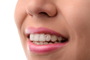 How Invisalign Can Straighten Those Crooked Teet