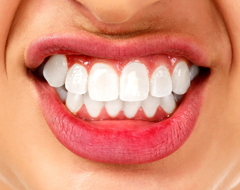 Why Do You Grind Your Teeth At Night 