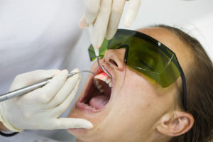 The Basics of Laser Dentistry