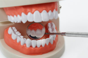 What Happens if My Dentures Stop Fitting?